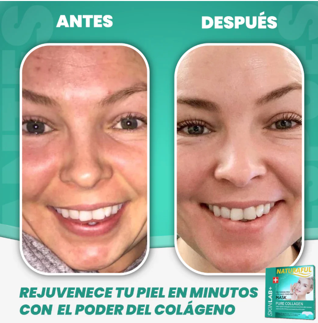 "💆‍♀️✨ Mascarilla Colágeno Soluble 5u ¡Revitaliza tu Rostro! Envío GRATIS. 🚚🌸"