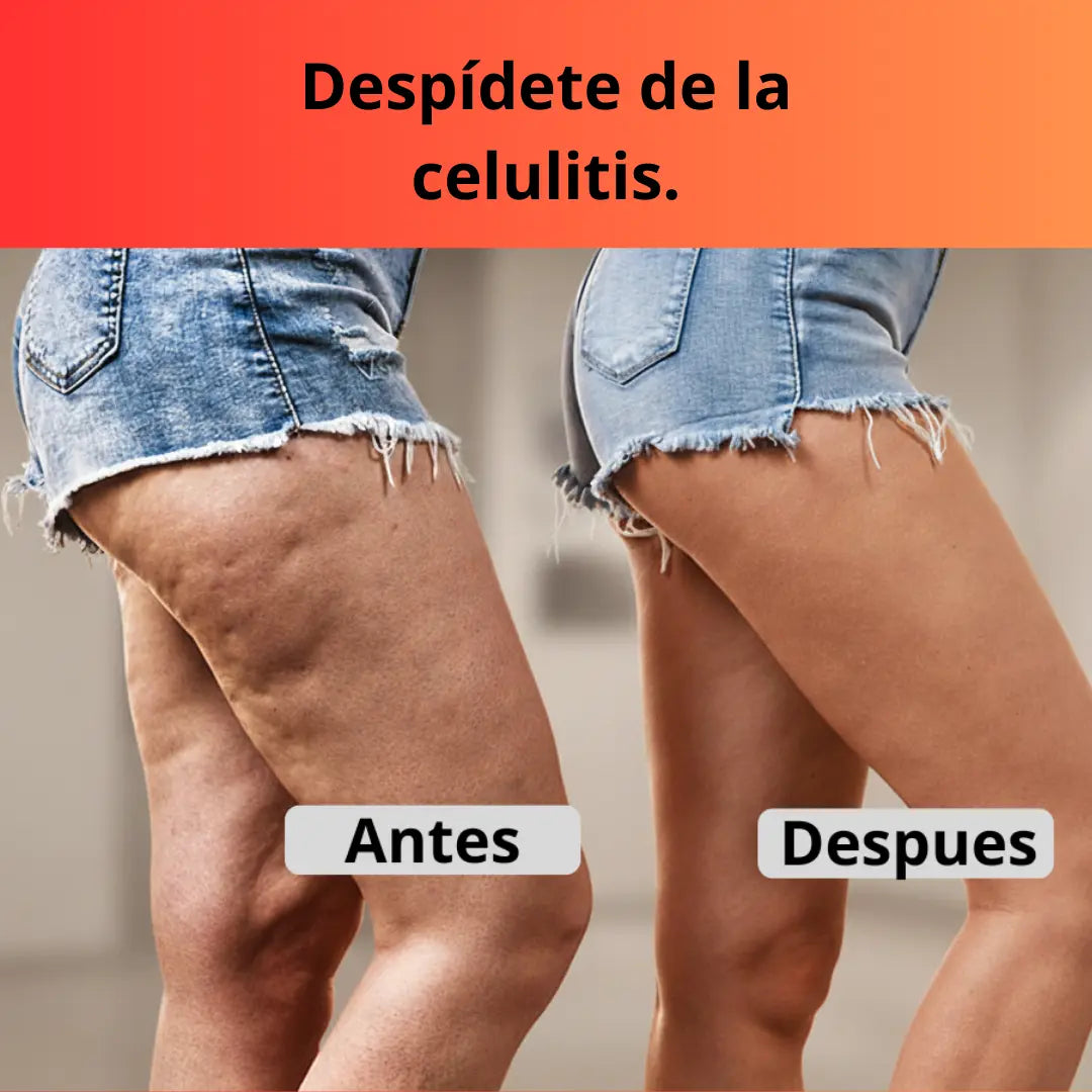 Ventosa Terapeutica Electrica Masaje