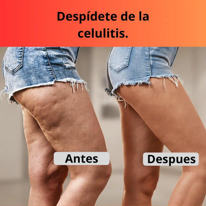 Ventosa Terapeutica Electrica Masaje